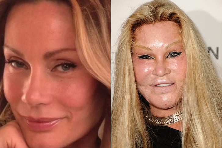 Celebs who are unrecognizable after having plastic surgery - Page 8 of ...