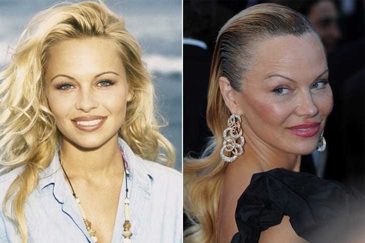 Celebs who are unrecognizable after having plastic surgery - Page 5 of ...