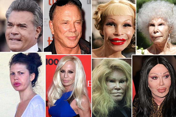 Celebs who are unrecognizable after having plastic surgery - MisterStocks